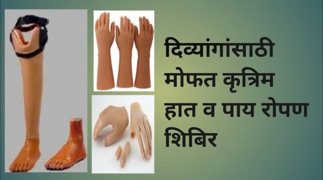 दिव्यांग व्यक्तींना कृत्रिम हात पाय बसविण्यासाठी शिबीरांचे आयोजन
